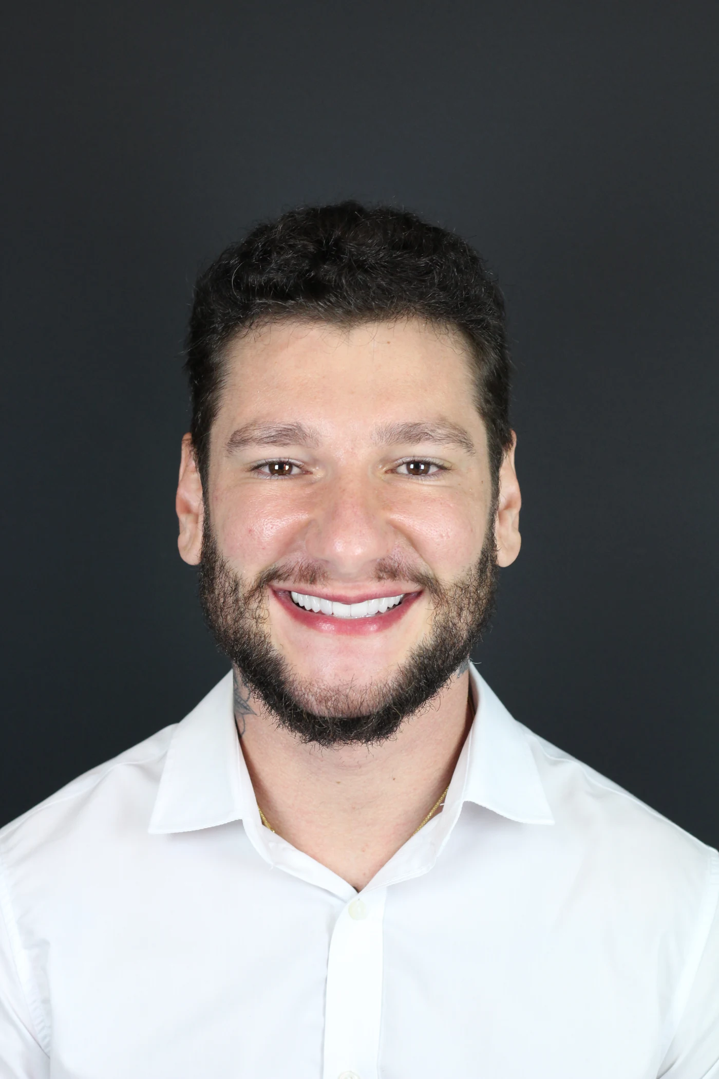 Retrato de paciente após tratamento com lentes de contato em porcelana